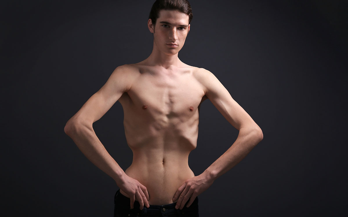 anorexic man